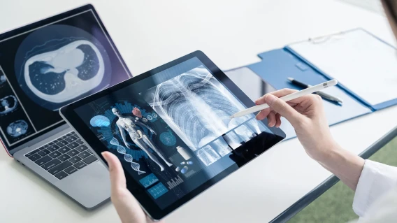 Doctor reviewing chest X-ray and diagnostic imaging on a tablet beside a laptop.